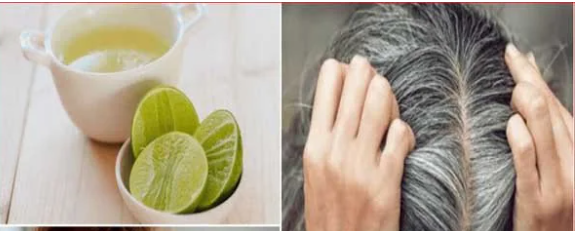 Wellhealthorganic.Com/Know-The-Causes-Of-White-Hair-And-Easy-Ways-To-Prevent-It-Naturally